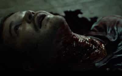 Scratch that “ITCH!” with the infection-horror movie’s trailer, poster & release info